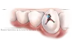 Pinnacle Dental